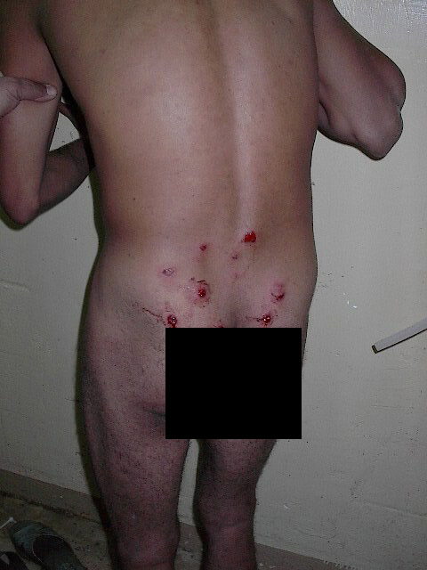 Medios australianos publican 15 fotos de las torturas en Irak que Obama quiere vetar Medios australianos publican 15 fotos de las torturas en Irak que Obama quiere vetar