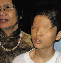 Hanoi y Washington, 40 años después, enfrentan el problema de la dioxina Hanoi y Washington, 40 años después, enfrentan el problema de la dioxina