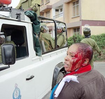 Cinco muertos y 60 heridos en manifestación de oposición en Tanzania Cinco muertos y 60 heridos en manifestación de oposición en Tanzania