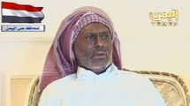 Ali Abdala Saleh, tras la operación por las quemaduras en su cara. Ali Abdala Saleh, tras la operación por las quemaduras en su cara.