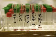 Nobel de Medicina recompensa a trío de expertos sobre sistema inmunitario Nobel de Medicina recompensa a trío de expertos sobre sistema inmunitario