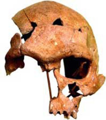 Humanos prehistóricos ya tenían caries y mal aliento, señala estudio Humanos prehistóricos ya tenían caries y mal aliento, señala estudio