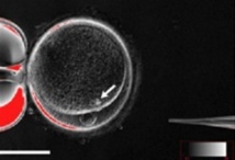 Primera clonación de células adultas para crear células madre embrionarias