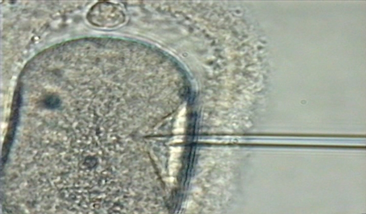 Una inyección intracitoplasmática Una inyección intracitoplasmática