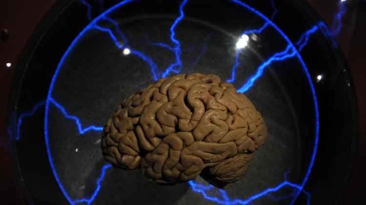 ¿Mala memoria? EEUU desarrolla implantes cerebrales para restaurar recuerdos