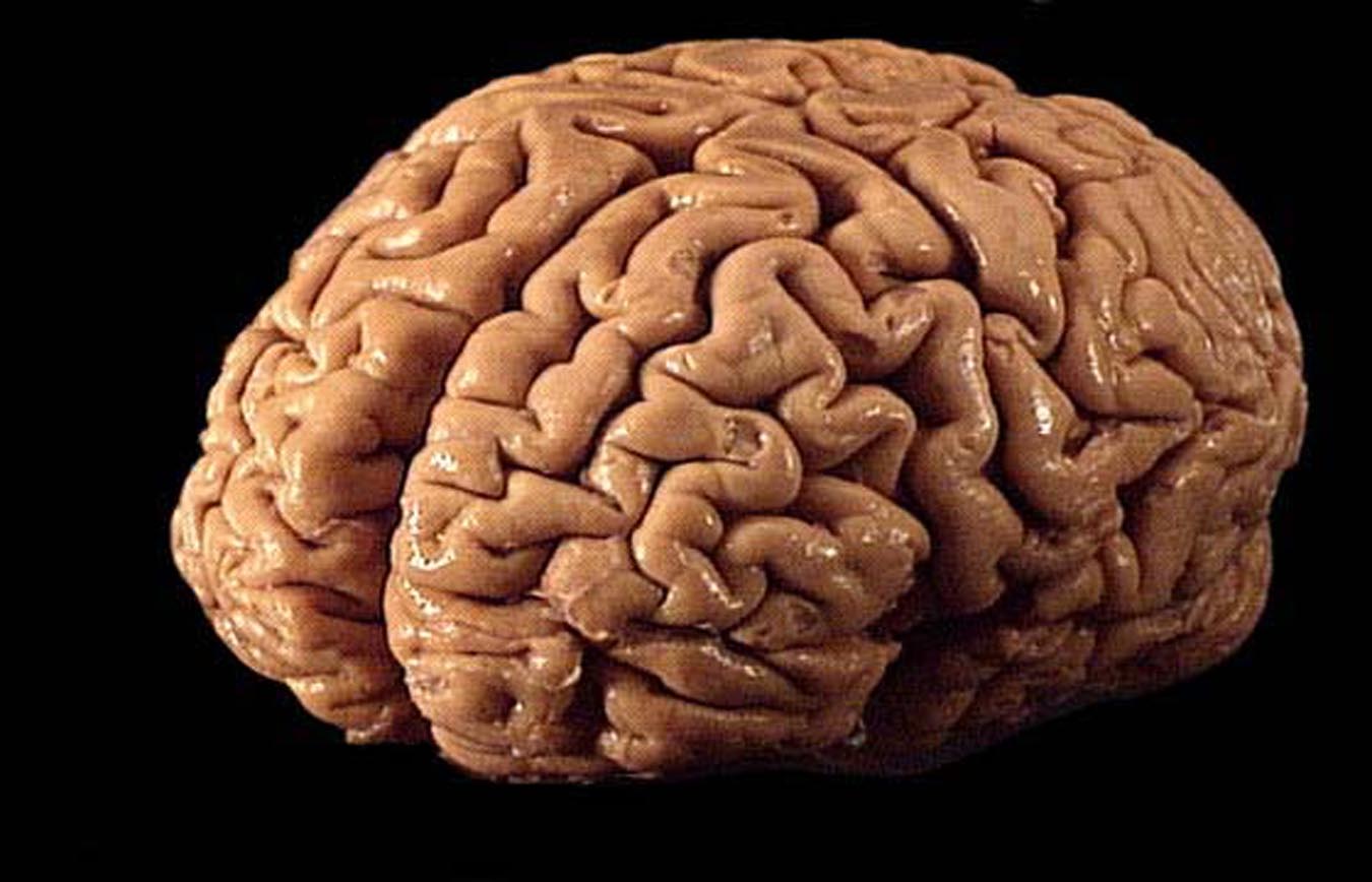 Un cerebro